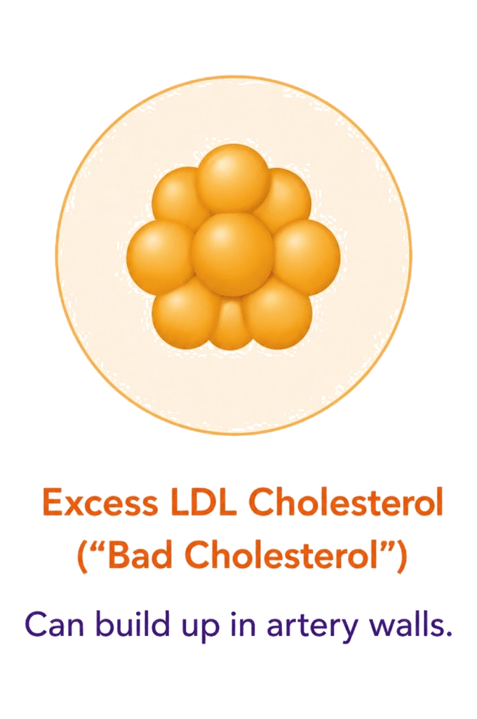 Cholesterol particles representing elevated LDL levels